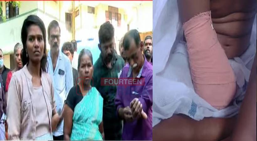 ചികിത്സാപിഴവ്; കൈ മുറിച്ചു മാറ്റേണ്ടി വന്ന കുട്ടിക്ക് ഇന്ന് ശസ്ത്രക്രിയ 1