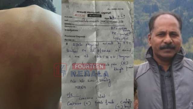 കായികാധ്യാപകൻ്റെ ക്രൂരത; പയ്യന്നൂരിൽ എട്ടാം ക്ലാസ് വിദ്യാർത്ഥിക്ക് നേരെ ക്രൂരമർദ്ദനം; പൊലീസ് കേസെടുത്തു 1