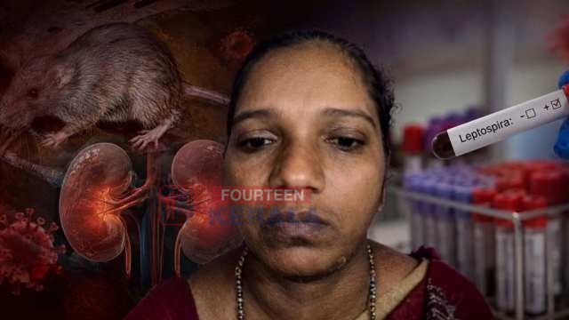 കോഴിക്കോട് കൂരാച്ചുണ്ടിൽ എലിപ്പനി ബാധിച്ച് 57-കാരി മരിച്ചു 1
