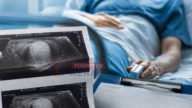 ഹോസ്റ്റലിലെ ലഹരി ഉപയോഗം അധ്യാപകരെ അറിയിച്ചതിൽ പക; വിദ്യാർഥിയുടെ ജനനേന്ദ്രിയം സഹപാഠികൾ മർദ്ദിച്ച് തകർത്തു 1