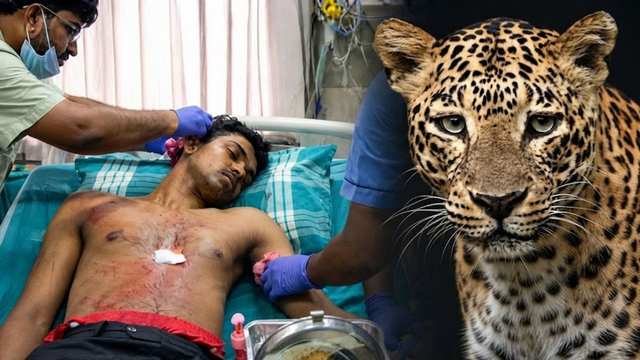 കുഴിയിൽ ഒളിഞ്ഞിരുന്ന പുലി പിറകിലേക്ക് ചാടി; നാദാപുരം കുമ്മങ്കോടിൽ സിനാനു നേരെ ഉണ്ടായത് പുലിയുടെ ആക്രമണം, 64ലധികം തുന്നലുകൾ 1